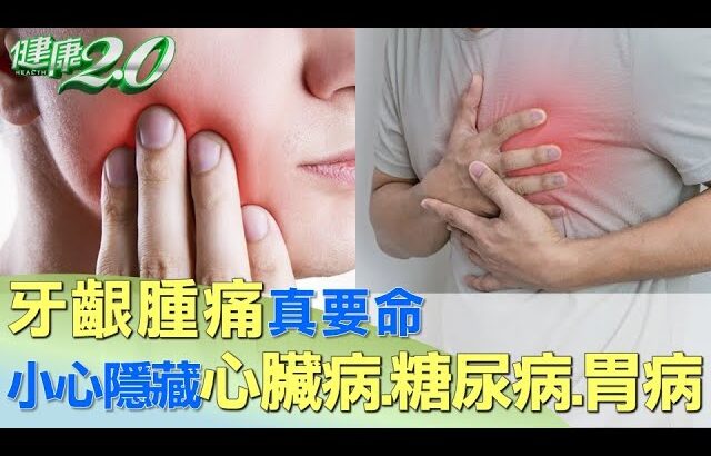 牙齦腫痛真要命 小心隱藏心臟病.糖尿病.胃病 健康2.0 @tvbshealth20