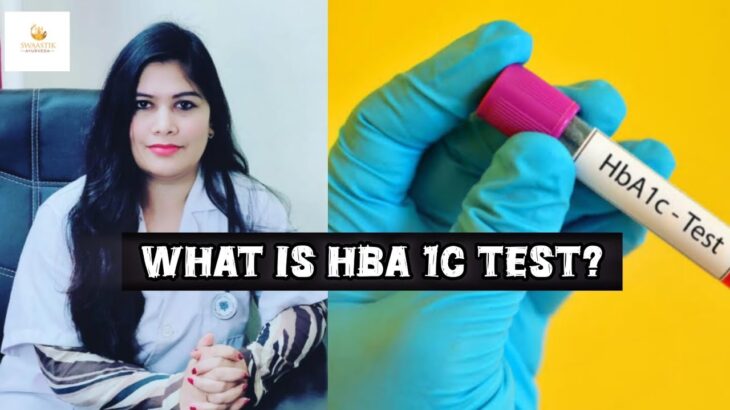 What Is an HbA1c Test? Understanding Your Blood Sugar Levels Made Simple