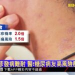 帶狀疱疹發病難耐 醫：糖尿病友高風險群要當心@newsebc