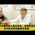 内蒙古糖尿病人慕名而来，出现尿蛋白，老中医告诉你最根本原因