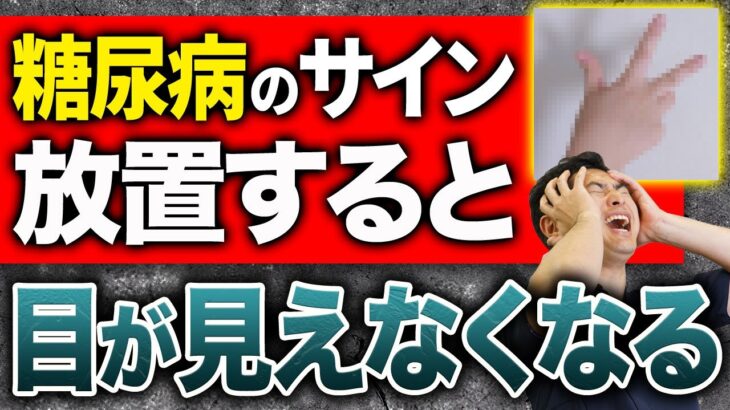 【ばね指】糖尿病を疑う手の病気4選を整形外科専門医が解説！