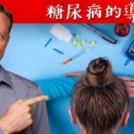 5種會糖尿病的原因,不只吃糖高血糖,還有其他原因,柏格醫生 Dr Berg