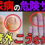 【糖尿病専門医監修】絶対に見逃してはいけない危険なサイン！99%の人が知らない糖尿病の治し方！【HbA1c13→6%】薬に頼らず血糖値が必ず下がる方法