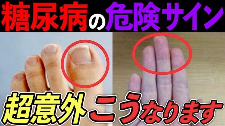 【糖尿病専門医監修】絶対に見逃してはいけない危険なサイン！99%の人が知らない糖尿病の治し方！【HbA1c13→6%】薬に頼らず血糖値が必ず下がる方法