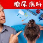 如何判斷有糖尿病？自然療法,柏格醫生 Dr Berg