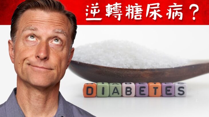 糖尿病可以逆轉嗎？自然療法,柏格醫生 Dr Berg