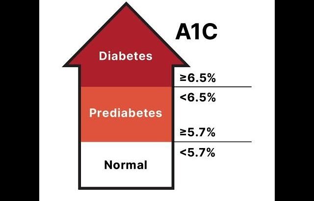 Best Biochemical Test for Diagnosis & Long Term Monitoring of Diabetes Mellitus (Glycated Hemoglobin