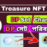 Treasure NFT DP update | Treasure NFT DP set or change