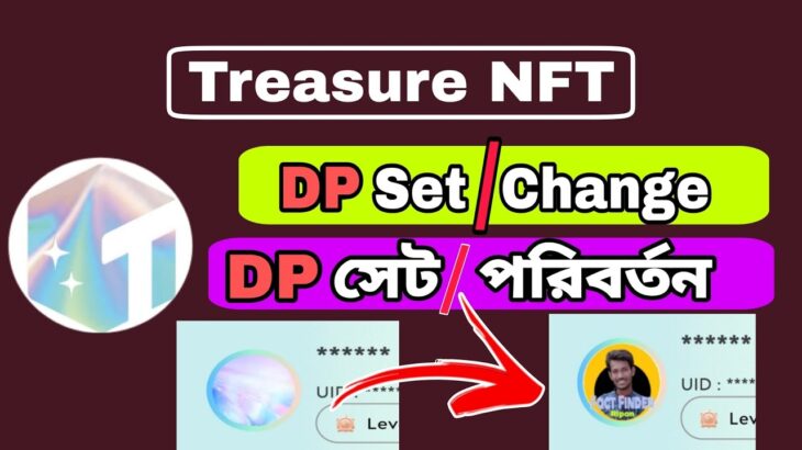 Treasure NFT DP update | Treasure NFT DP set or change