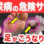 【知らないと後悔】糖尿病「足」の危険サイン。糖尿病は知らないうちに進行しています！