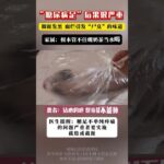 糖尿病足后果很严重，脚趾发黑腐烂引发“尸臭”的味道 抖出健康知识宝藏   开工去班味健康指南    沈阳二四二医院  王强教授  糖尿病足