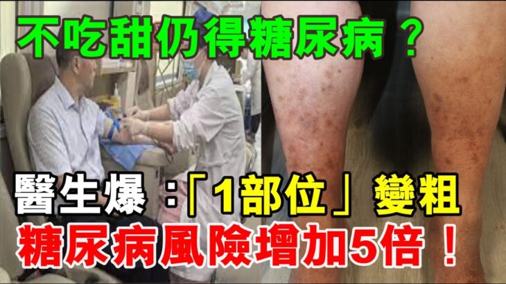 不吃甜仍得糖尿病？醫生爆：「1部位」變粗是警訊，糖尿病風險增加5倍！