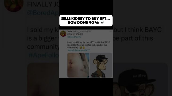 Guy sells kidney to buy Bored Ape NFT, which is now down 90%