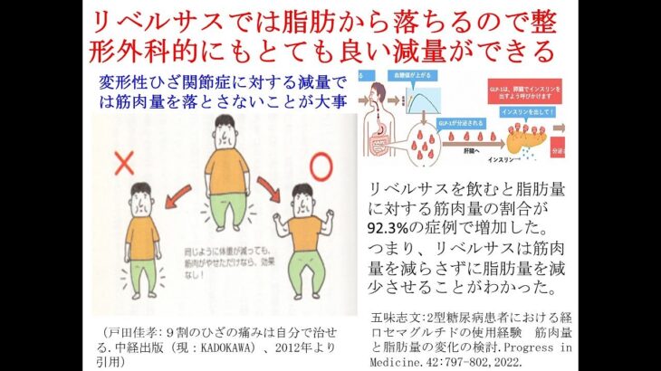 美容医療で痩せ薬として利用されている糖尿病薬は整形外科的にも優れた減量ができる。