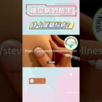 糖尿病的类型：1型 vs 2型 vs 妊娠糖尿病，有何区别？ 什么是糖尿病？  #糖尿病 #stevenhealthandwellness