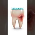 糖尿病と歯の関係 #diabetes #雑学 #糖尿病