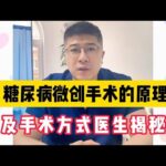 糖尿病手术的原理和方式，1分种讲清楚，糖友更放心