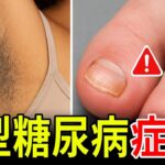 小心！你可能忽略的 13 個 2 型糖尿病警訊，別讓糖尿病悄悄找上門| ByBy