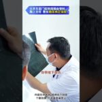 30岁透析患者糖尿病足，遇到厦门出诊的鞠主任，能否逆转危机？ #糖尿病 #糖足保肢  #糖尿病治疗  #糖尿病足  #鞠上