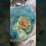 指こそぎ落として萎えた糖尿病831日目食事記録 #糖尿病