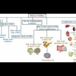 Classification of Diabetes Mellitus ; Type 1, Type 2, Gestational, Other Types