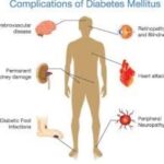 Classification of chronic complications of Diabetes Mellitus; Macrovascular And Microvascular