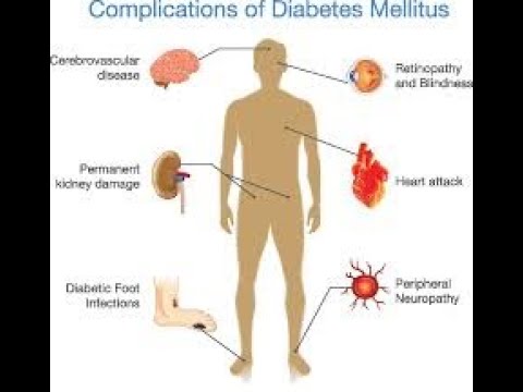 Classification of chronic complications of Diabetes Mellitus; Macrovascular And Microvascular