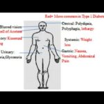 Clinical Features of Diabetes Mellitus (Signs and symptoms, Clinical presentation)