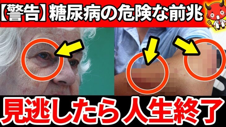 【放置厳禁】知らないと一生後悔！糖尿病のやばすぎる初期症状とは…【糖尿病・血糖値・HbA1c】