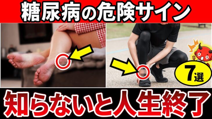 【放置厳禁】知らないと一生後悔…糖尿病で起きやすい「足」のやばすぎるSOSサイン7選・糖尿病を予防する食事療法【糖尿病・高齢者・血糖値・HbA1c】