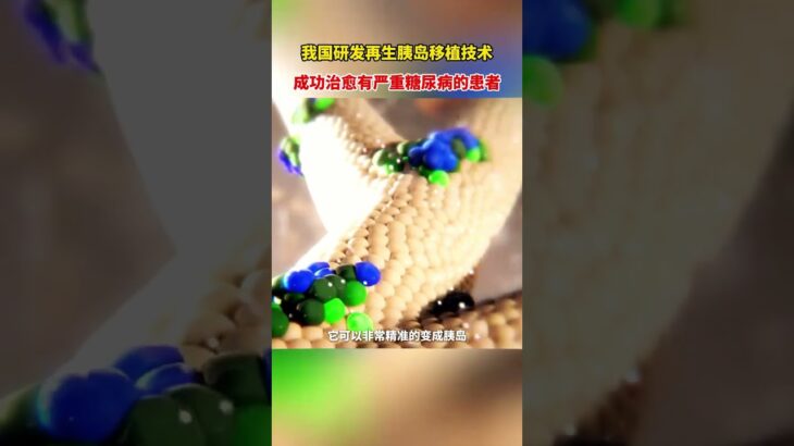 我國研發再生胰島移植技術，成功治癒有嚴重糖尿病的患者👍