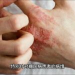 沉默的“杀手”糖尿病，可能在慢慢与我们靠近。糖尿病主要由多种因素，中医既可以通过中药调理，针灸治疗等手段有效预防糖尿病，降低高血糖的风险。 #二型糖尿病 #中医 #中药 #针灸