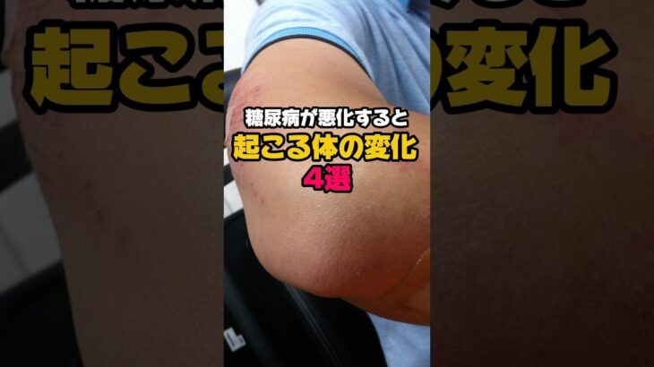 糖尿病が悪化すると起こる体の変化！ #雑学 #プチ知識 #健康豆知識 #糖尿病 #血糖値