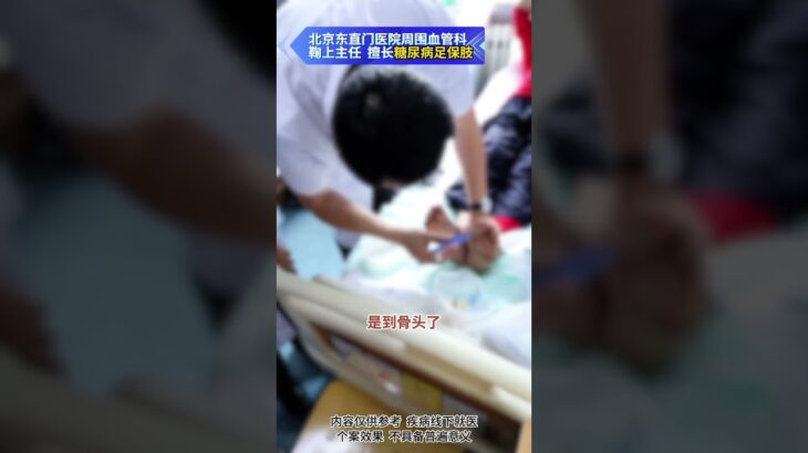 【糖足保肢查房】糖足神经病变也会烂脚吗？ #糖尿病 #糖足保肢  #糖尿病治疗  #糖尿病足  #鞠上