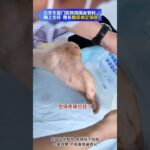【糖足保肢查房】又要保肢 又要省钱 医生处处为患者着想 #糖尿病 #糖足保肢  #糖尿病治疗  #糖尿病足  #鞠上