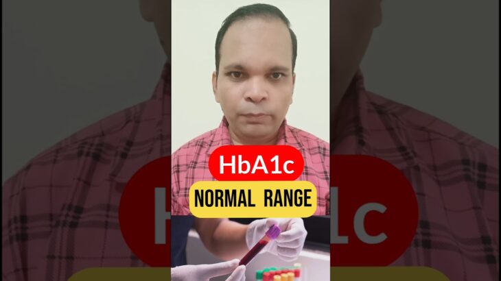 HbA1c Test 🩸💯  #shorts #short #test