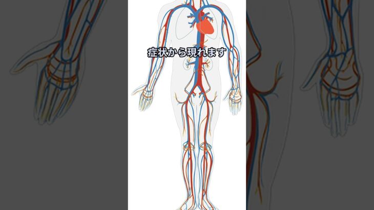 糖尿病足切断の危機と予防 #diabetes #糖尿病 #プチ知識 #雑学