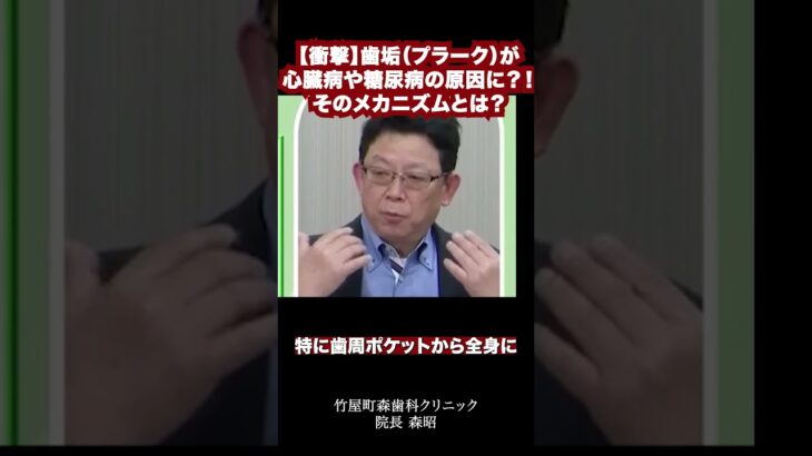 【衝撃】歯垢（プラーク）が心臓病や糖尿病の原因に？！そのメカニズムとは？