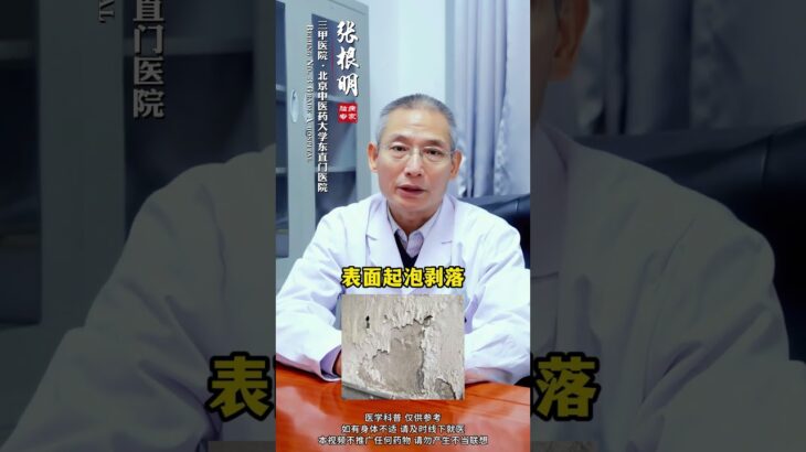 糖尿病是如何一步一步损伤脑小血管的#糖尿病 #脑小血管 #腔隙性脑梗 #脑白质病变