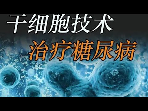 干细胞技术治疗糖尿病  #糖尿病 #干细胞 #糖尿病科普