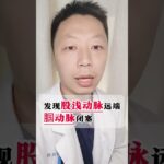 这个患者治疗比较及时，效果也比较好！ #糖尿病足 #糖尿病足坏疽 #下肢动脉硬化闭塞症 #下肢动脉硬化闭塞症伴足趾坏疽