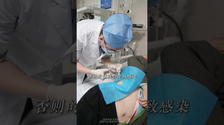 脊髓电刺激针对糖尿病周围神经病变有哪些优势？ #抖出健康知识宝藏  #脊髓电刺激  #糖尿病周围神经病变  #糖尿病足  #神经外科