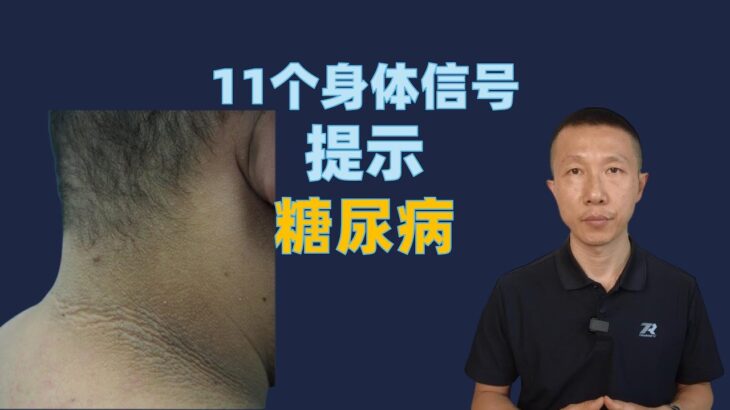 11个身体信号提示糖尿病