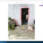 12.食道口腔肺糖尿病的案例