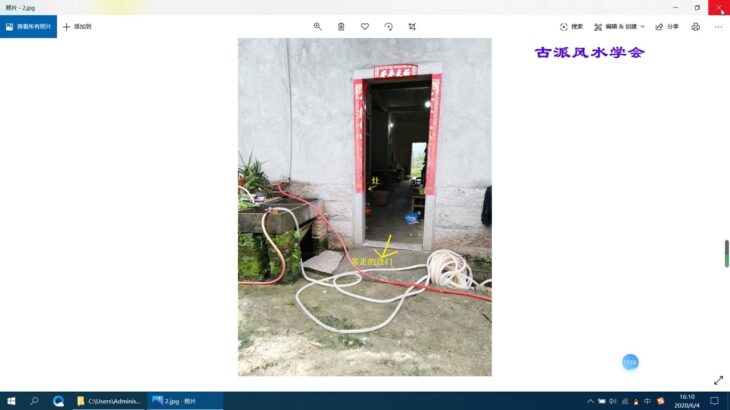 12.食道口腔肺糖尿病的案例
