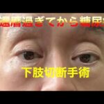 糖尿病悪化下肢切断手術#糖尿病#2型糖尿病 #下肢切断手術#還暦