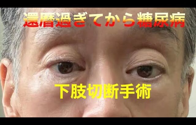 糖尿病悪化下肢切断手術#糖尿病#2型糖尿病 #下肢切断手術#還暦