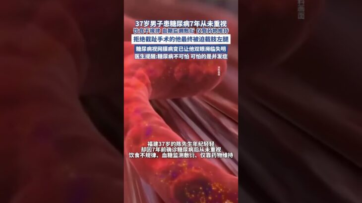 37歲男子患糖尿病7年從未重視， 拒絕截趾手術的他最終被迫截肢左腿（都市時報 ）