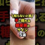 知らないと損✨️手に現れる糖尿病のサイン5選#今日から使える健康情報館