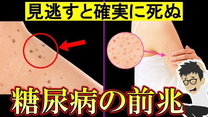 恐ろしい糖尿病の危険なサイン5選と改善法！【高血糖｜食事｜ヘモグロビンa1c｜予防｜HbA1cを下げる方法】